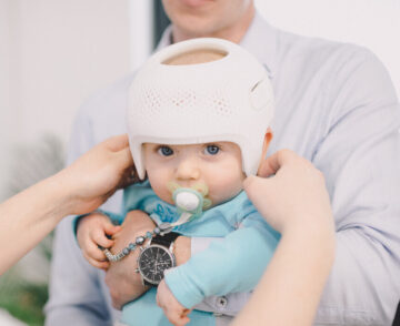 علامات تحذرك لمراجعة خوذة علاج الرأس المسطح فورًا مع الطبيب لحماية طفلك