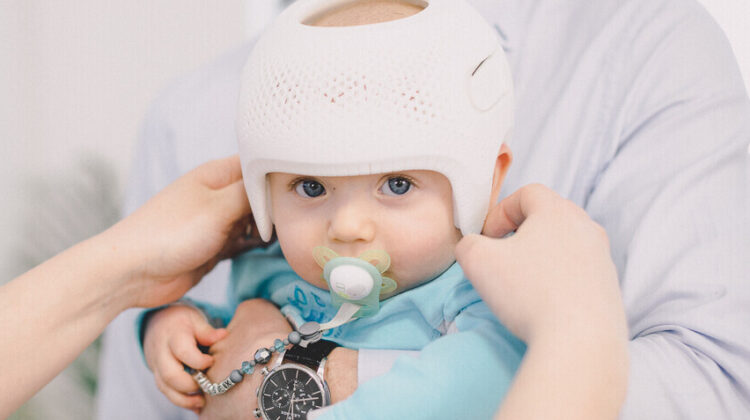 علامات تحذرك لمراجعة خوذة علاج الرأس المسطح فورًا مع الطبيب لحماية طفلك