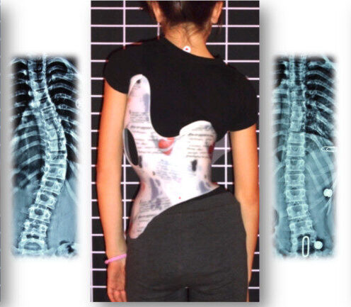 لماذا سعر حزام اعوجاج العمود الفقري الفعّال مرتفع؟