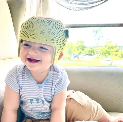 لماذا تختلف أسعار خوذة علاج الرأس المسطح؟ دليل الأهل لفهم الفروق