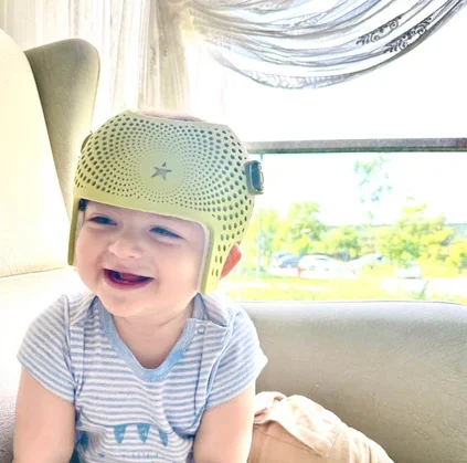 لماذا تختلف أسعار خوذة علاج الرأس المسطح؟ دليل الأهل لفهم الفروق