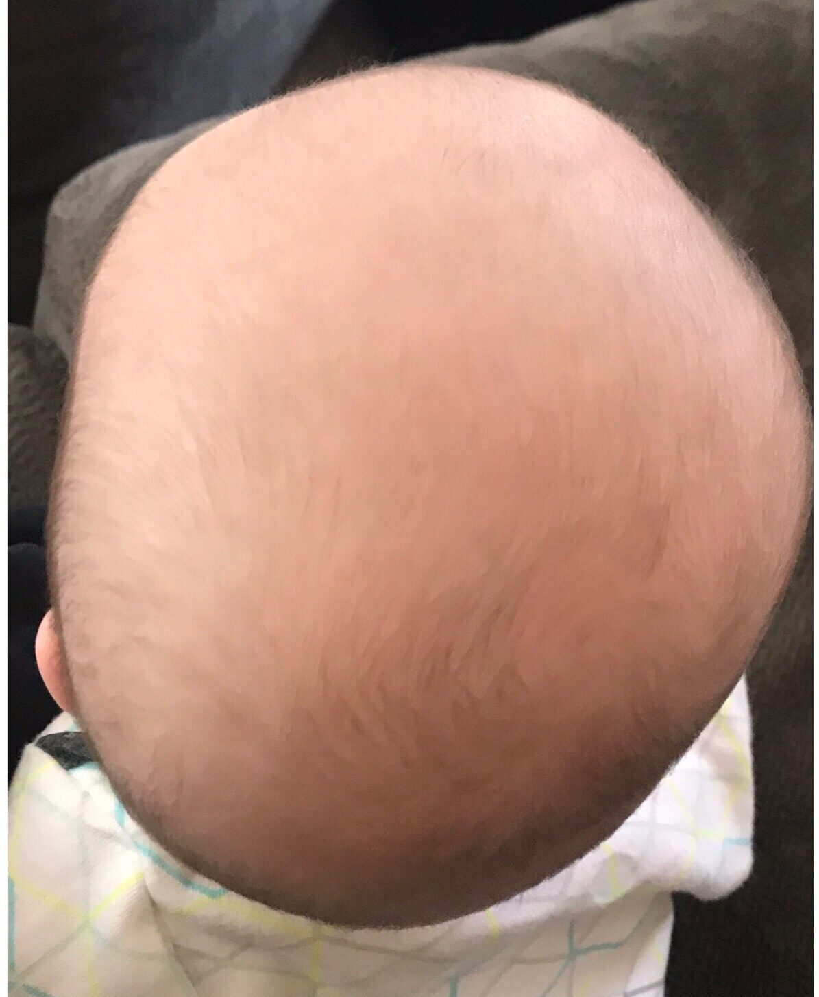 متى يجب القلق بشأن جمجمة الطفل؟