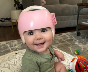 كيف يشعر الطفل عند ارتداء خوذة علاج الرأس المسطح؟