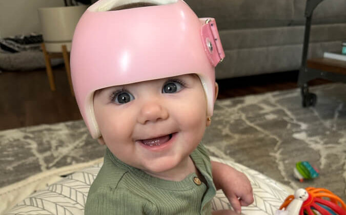 كيف يشعر الطفل عند ارتداء خوذة علاج الرأس المسطح؟
