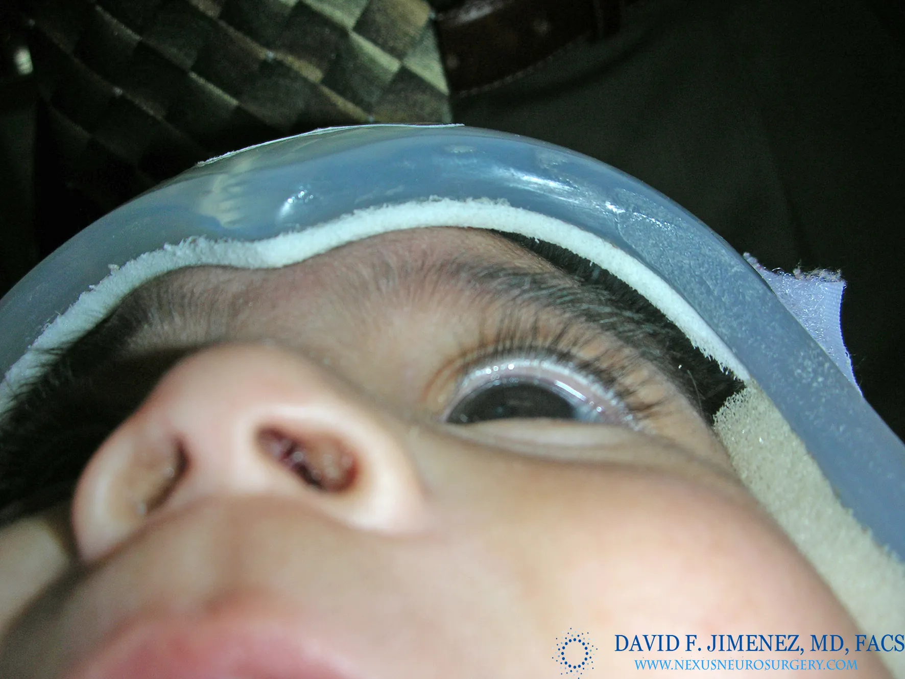 ماذا يحدث عند حدوث خطأ في تصنيع أو تصميم خوذة علاج الرأس المسطّح؟