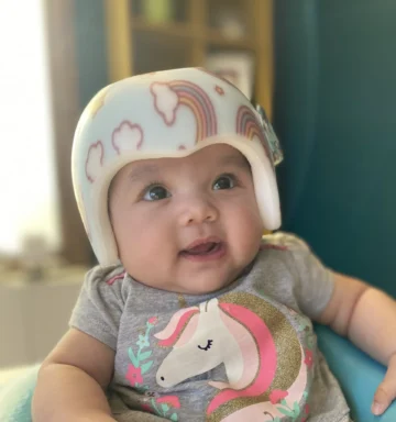 متى تبدأ الرأس بالاستجابة بعد ارتداء خوذة علاج الرأس المسطح؟