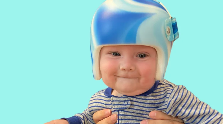 علامات تدل على أن خوذة علاج الرأس المسطّح لن تنجح: كيف تعرف فاعليتها قبل فوات الأوان؟