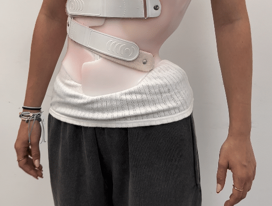 ما نوع البنطلون المناسب للارتداء مع حزام اعوجاج العمود الفقري؟