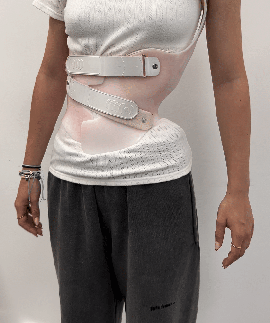 ما نوع البنطلون المناسب للارتداء مع حزام اعوجاج العمود الفقري؟