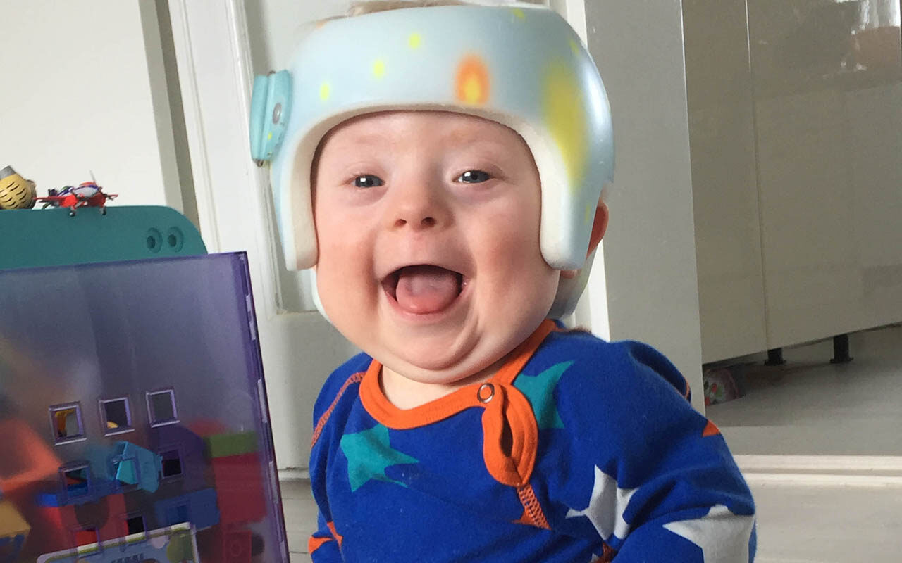 خوذة علاج الرأس المسطح للأطفال حديثي الولادة ذوي الاحتياجات الخاصة