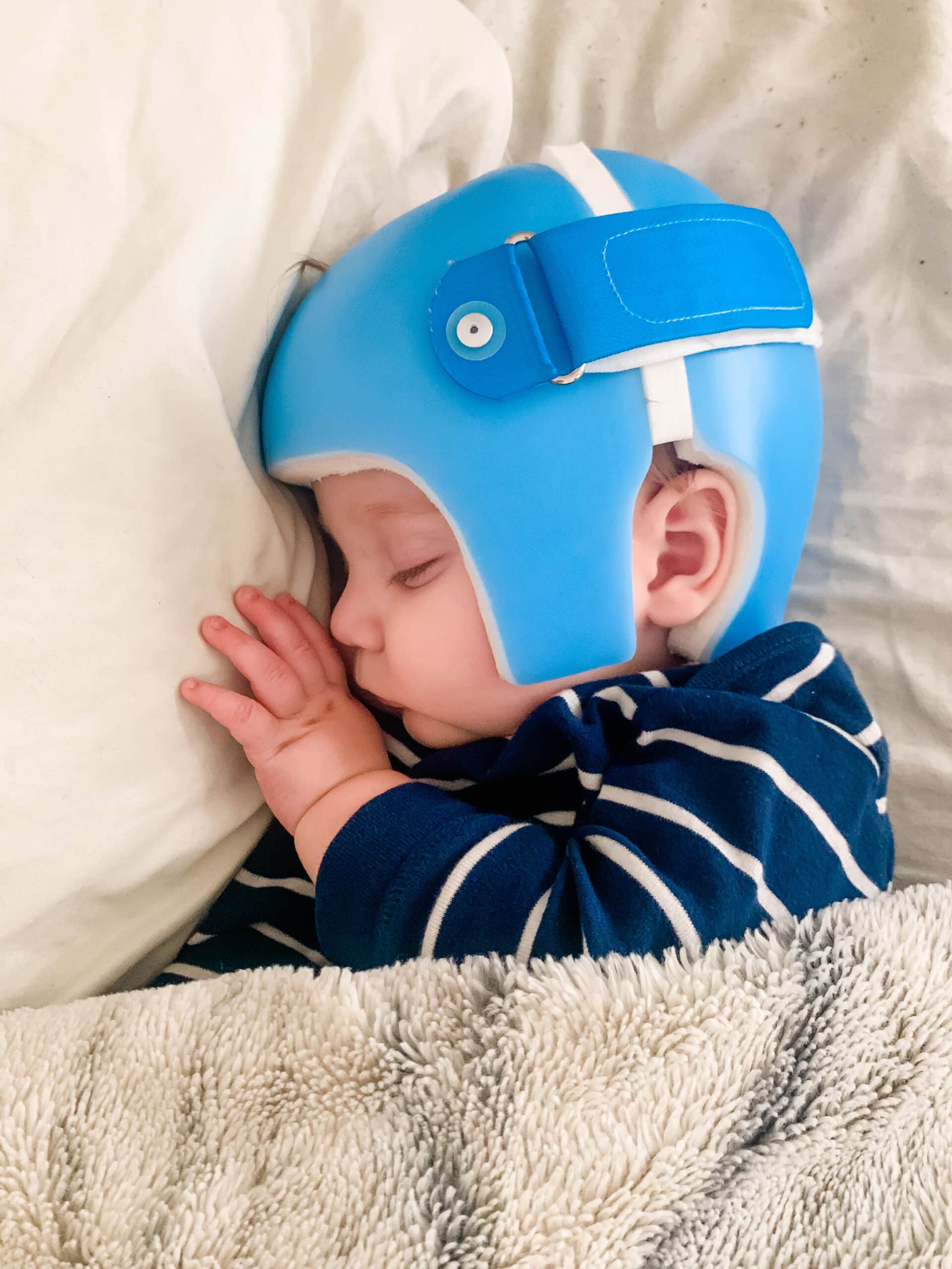 هل أستطيع خلع خوذة علاج الرأس المسطح لطفلي خلال النوم؟