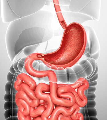 هل يمكن لإعوجاج العمود الفقري أن يسبب مشاكل في الأمعاء؟