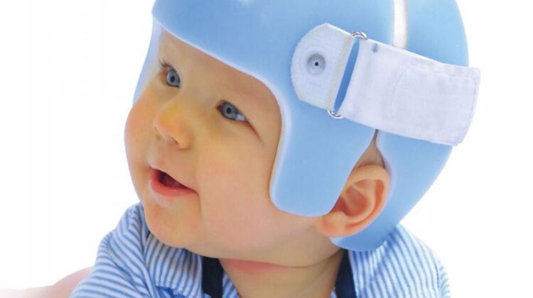 التجربة الأولى لخوذة علاج الرأس المسطح: دليل شامل لأول يوم لطفلك