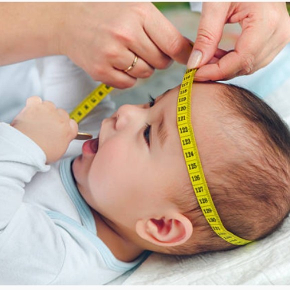تشخيص أشكال الرأس غير الطبيعية عند الرضع في مصر