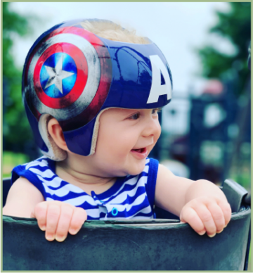 متى يكون استخدام خوذة علاج الرأس المسطح أقل فعالية؟