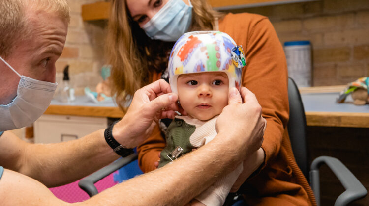 المرحلة الأخيرة قبل خلع خوذة الرأس المسطح: نصائح مهمه لضمان نجاح العلاج