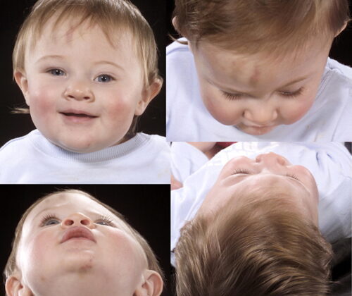 هل يؤدي عدم استخدام خوذة الرأس المسطح إلى تشوه دائم؟ حقائق هامة لكل أب وأم