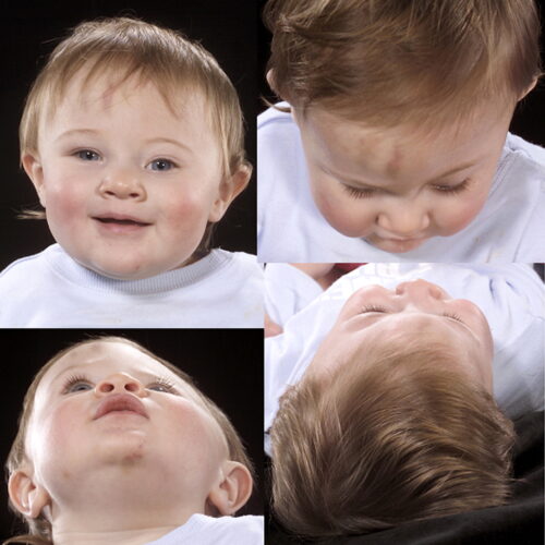 هل يؤدي عدم استخدام خوذة الرأس المسطح إلى تشوه دائم؟ حقائق هامة لكل أب وأم