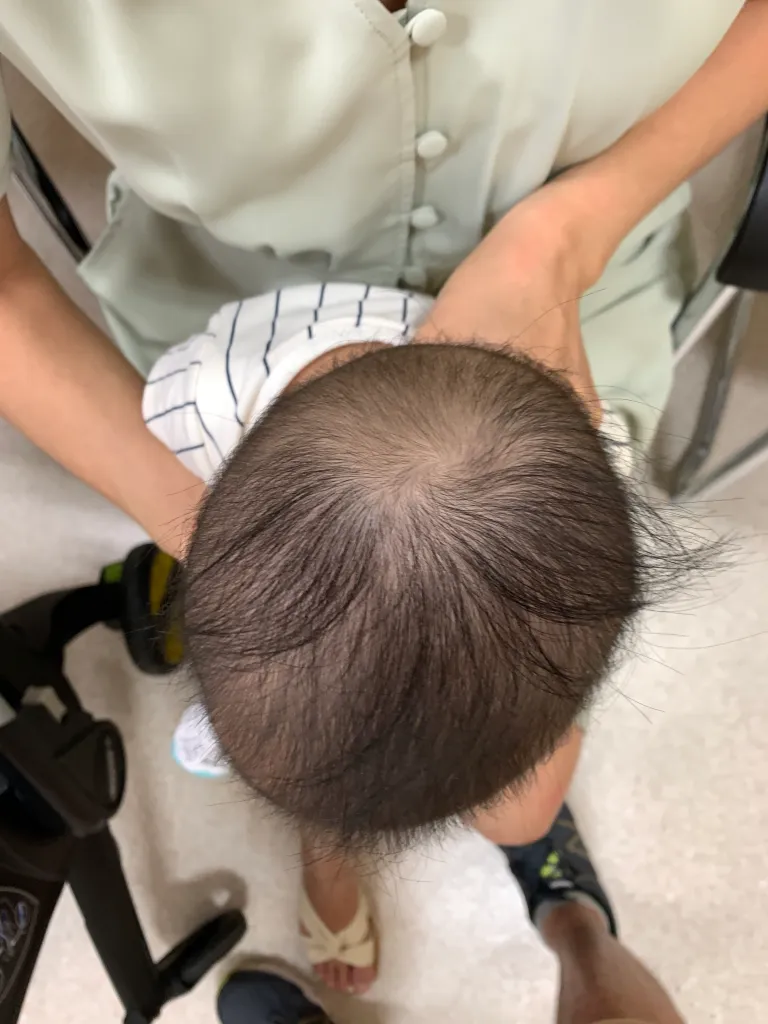متى يحتاج طفلك لتقييم طبي بسبب تسطح الرأس (Plagiocephaly)؟