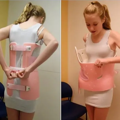 ارتداء حزام اعوجاج العمود الفقري بشكل فضفاض أو غير صحيح