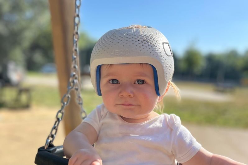 المدة المثالية لاستخدام خوذة الرأس بعد جراحة التحام الدروز السهمية عند الأطفال