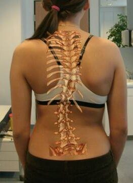 ما هي أسباب اعوجاج العمود الفقري عند النساء؟ تعرفي على العوامل وكيفية الوقاية