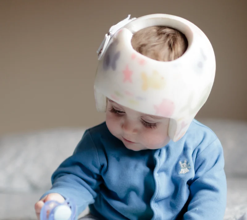 تسطّح الرأس عند الرضع: مدى انتشاره وكيف تساعد الخوذة في علاج طفلك