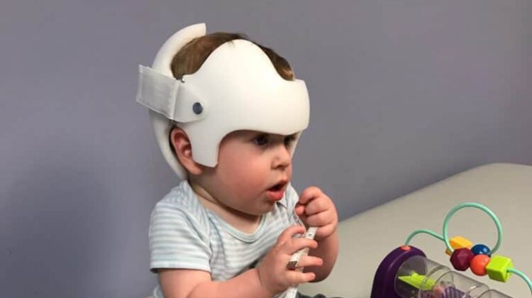 خوذة علاج الرأس المسطح: كيف تؤثر على حركة طفلك والنوم؟