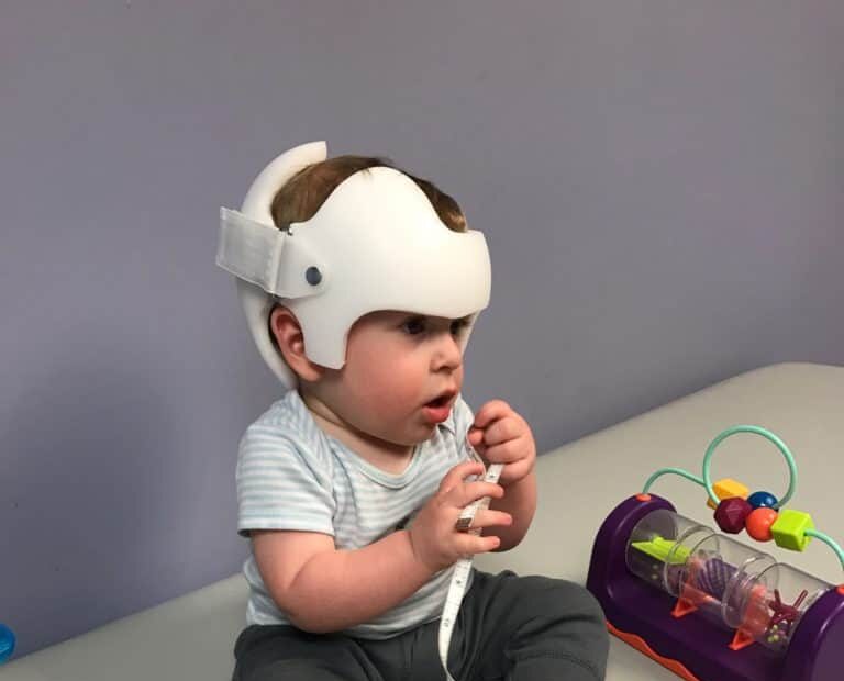 خوذة علاج الرأس المسطح: كيف تؤثر على حركة طفلك والنوم؟