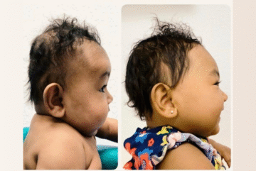 كيف تجعل شكل رأس طفلك دائريًا بشكل طبيعي؟ بدون خوذة