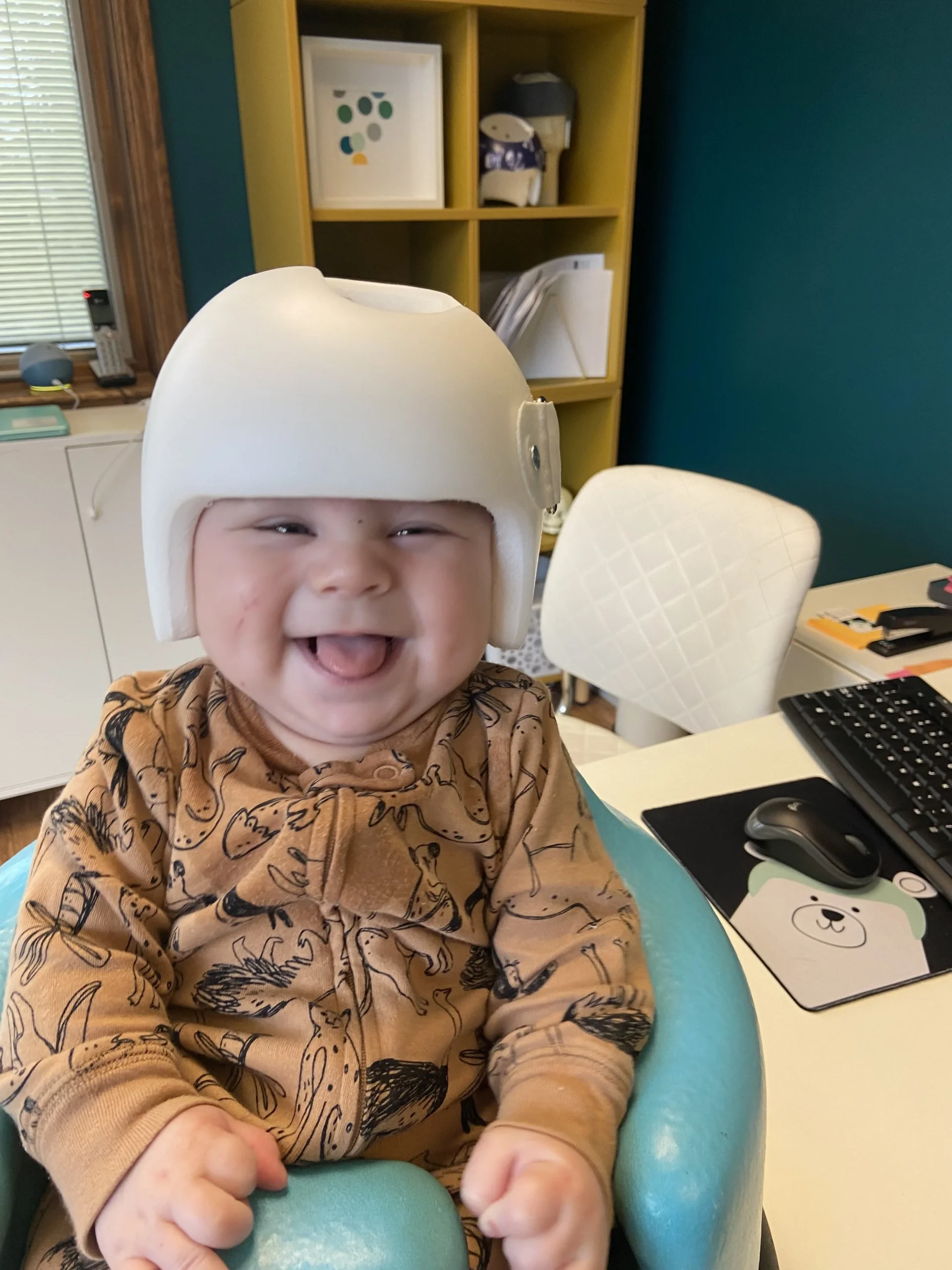 الخوذة أم الجراحة لعلاج الرأس المسطّح: كيف تؤثر كل طريقة على طفلك ونتائجه الصحية؟