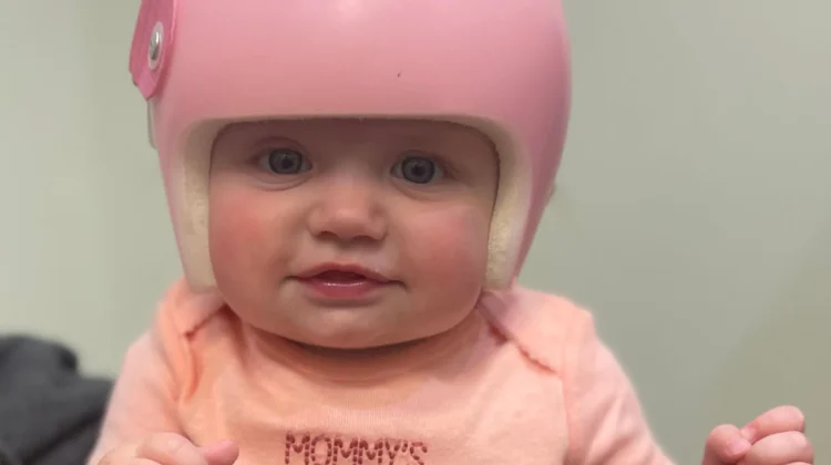 فشل خوذة الرأس المسطح: علامات التحذير المبكرة وكيفية التعامل معها