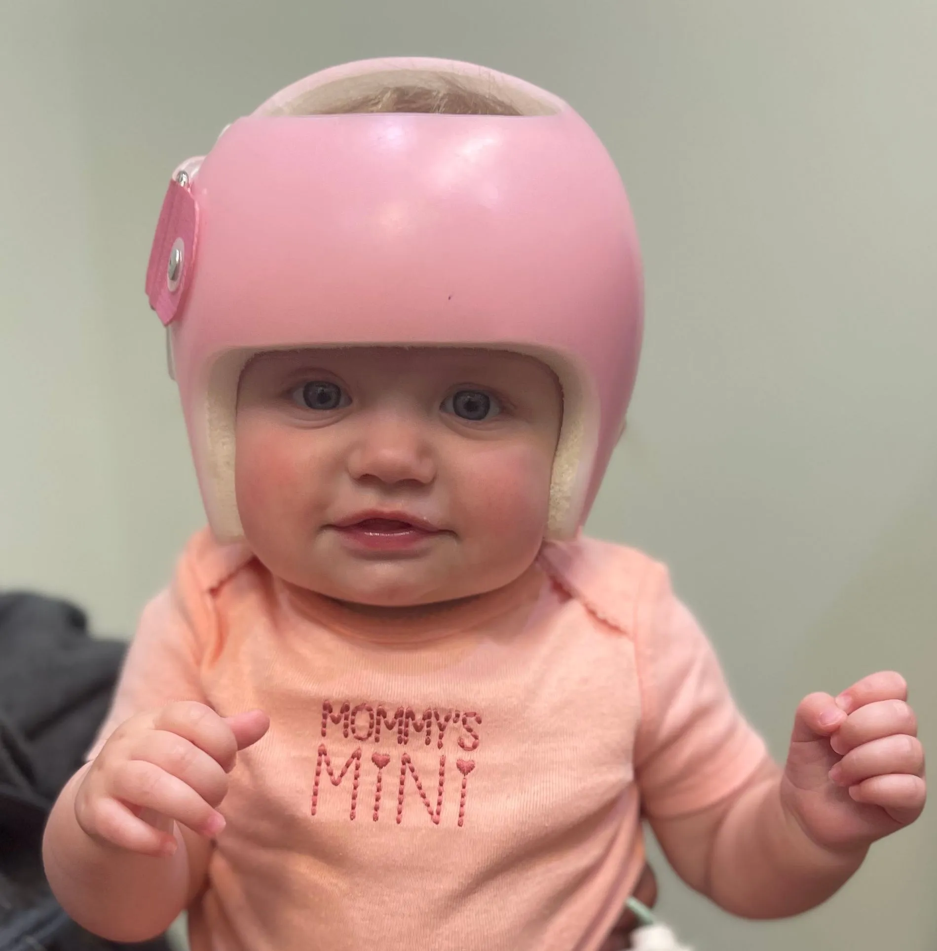 فشل خوذة الرأس المسطح: علامات التحذير المبكرة وكيفية التعامل معها