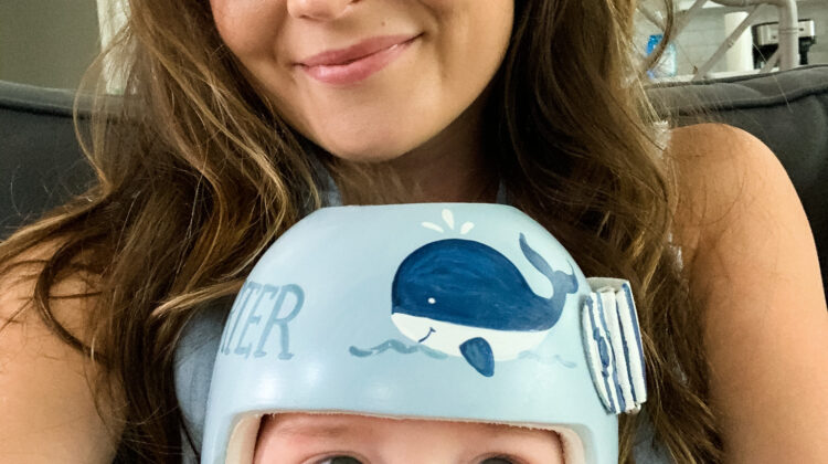 ماهو شعور الطفل عند ارتداء خوذة علاج الرأس المسطح؟ دليلك لتجربة آمنة ومريحة