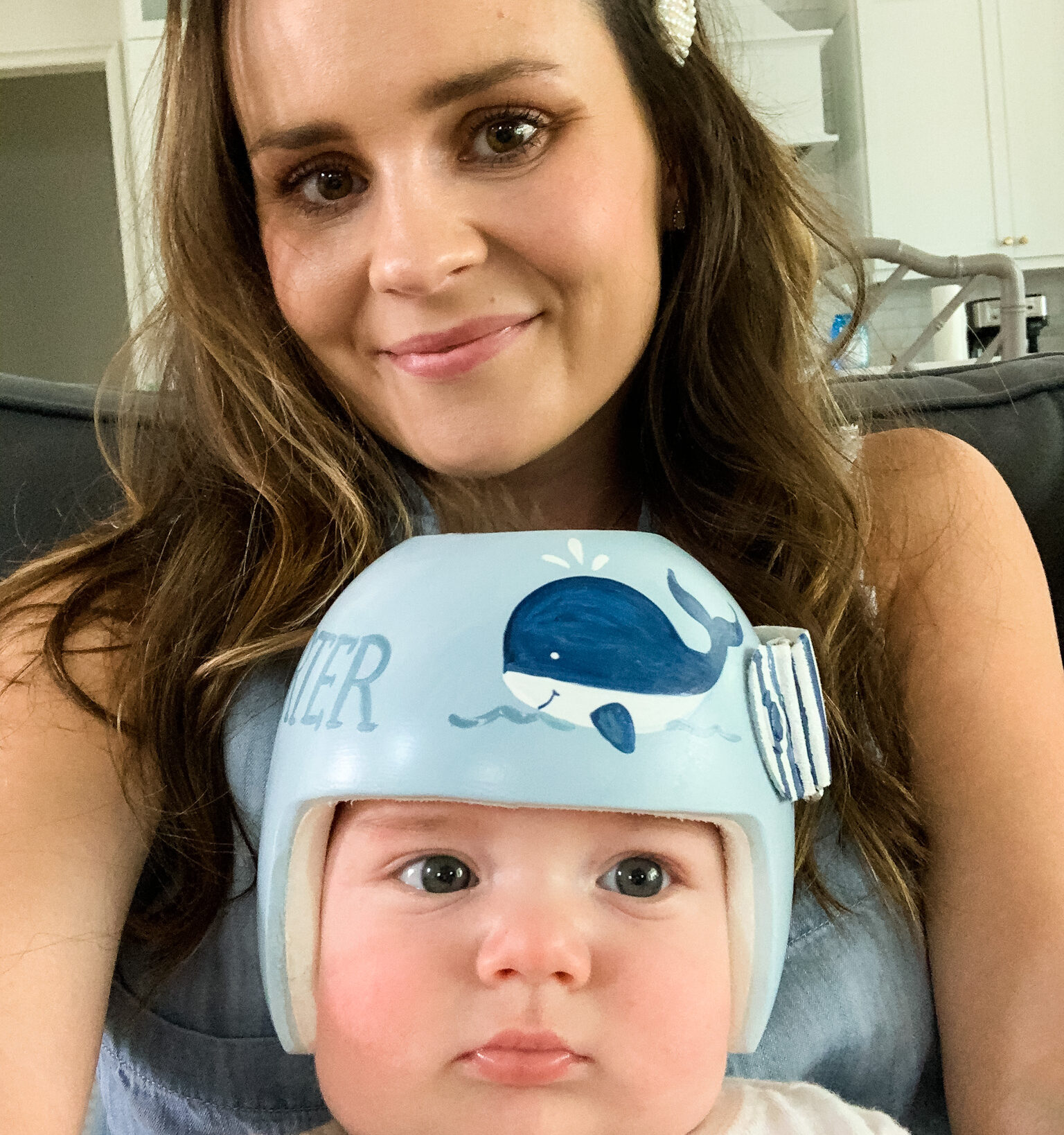 ماهو شعور الطفل عند ارتداء خوذة علاج الرأس المسطح؟ دليلك لتجربة آمنة ومريحة