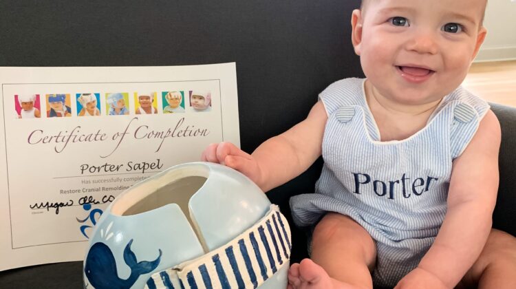 ما كنت اتمنى معرفته قبل بدء العلاج بخوذة الرأس المسطح لطفلي : تجارب ونصائح للأهل