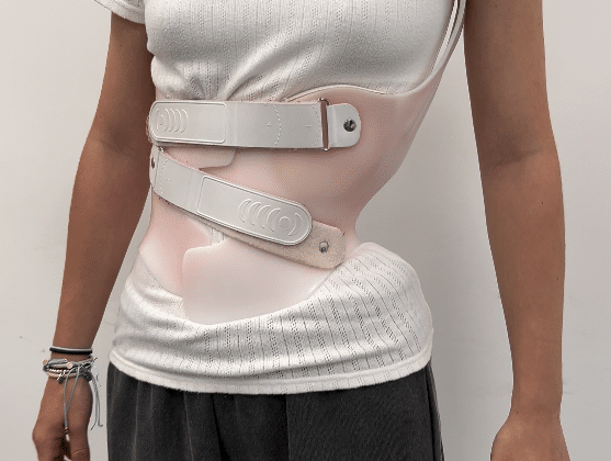 متى يتوقف حزام اعوجاج العمود الفقري عن العمل ويصبح غير ضروري؟