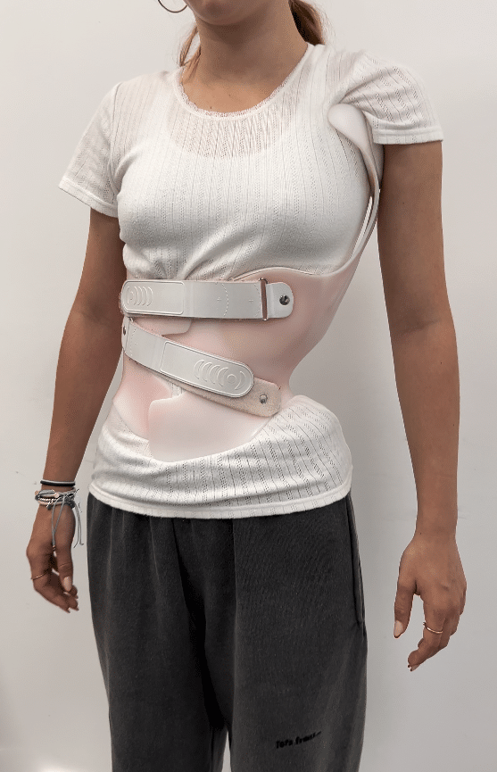 متى يتوقف حزام اعوجاج العمود الفقري عن العمل ويصبح غير ضروري؟