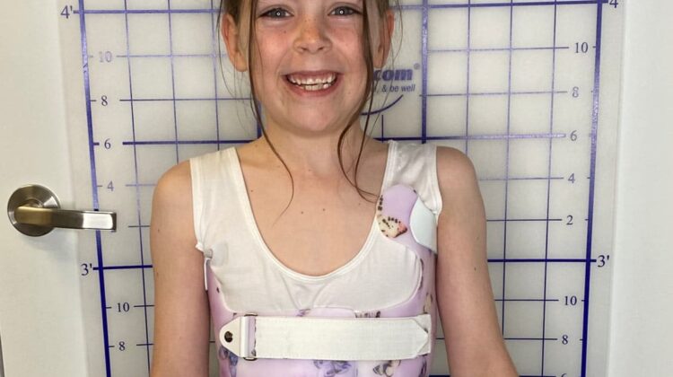 حزام اعوجاج العمود الفقري واختيار الملابس الداخلية: كيف تؤثر على راحة طفلك ونجاح العلاج