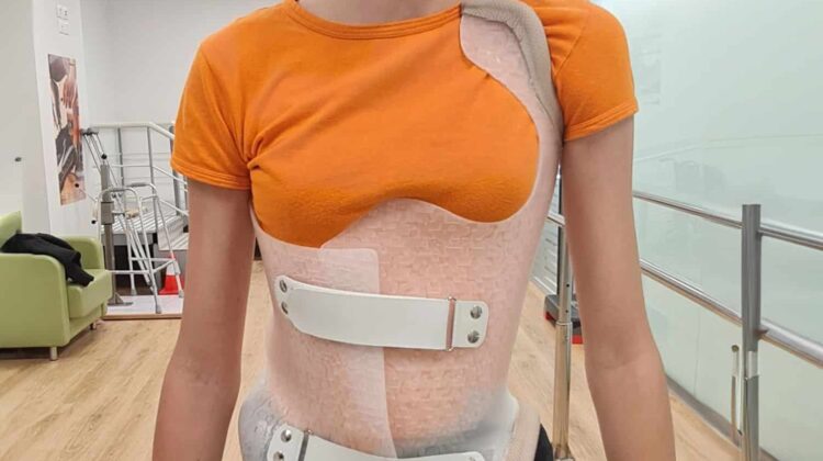 ما الذي لا يستطيع الطفل فعله أثناء ارتداء حزام اعوجاج العمود الفقري؟ دليلك لفهم حدود الحركة في الحياة اليومية