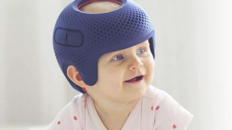 المستقبل والتطور في خوذات الرأس المسطح: اكتشف الثورة الجديدة في التطبيق والعلاج