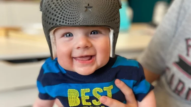 العوامل المؤثرة على التزام طفلك بخوذة علاج الرأس المسطح وكيفية ضمان نجاح العلاج