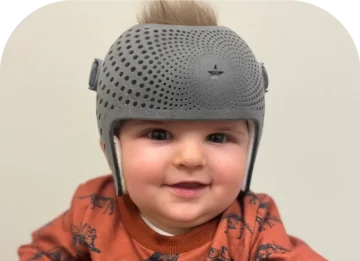 الخوذة الطبية لعلاج الرأس المسطّح: كيف تختلف عن الخوذة العادية؟