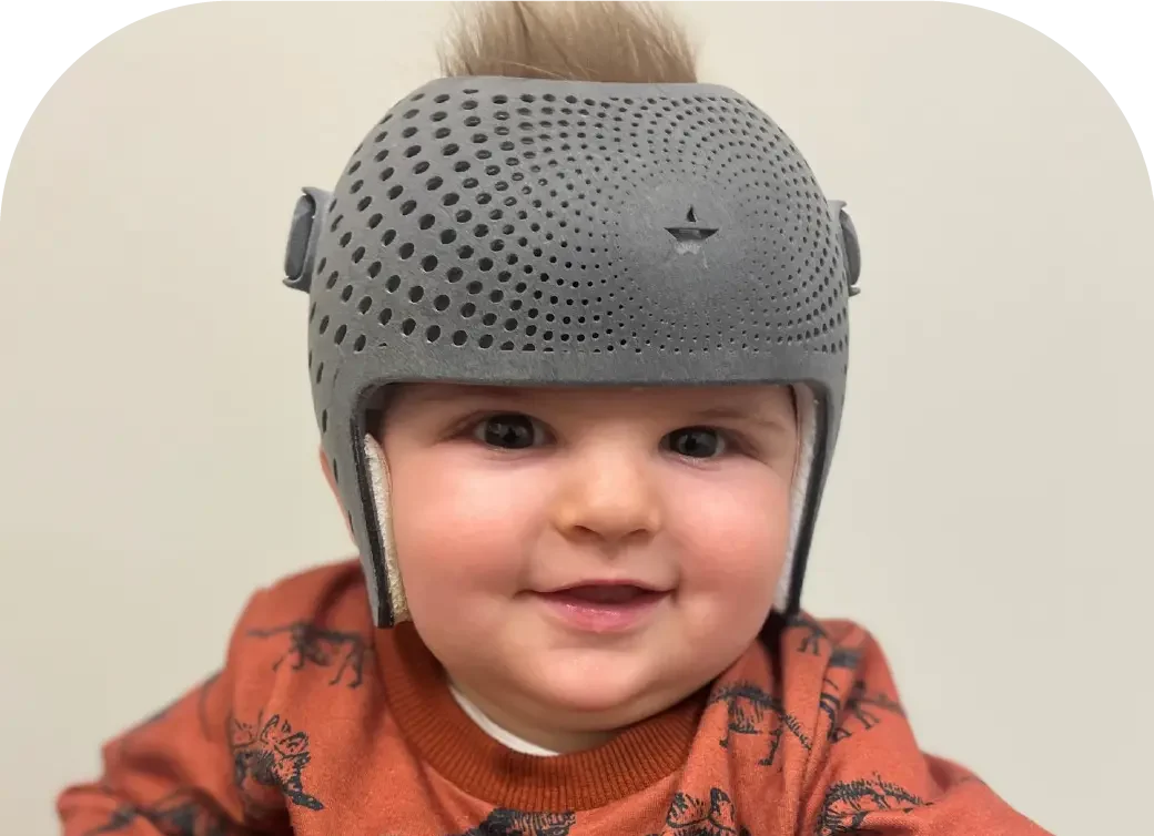 الخوذة الطبية لعلاج الرأس المسطّح: كيف تختلف عن الخوذة العادية؟