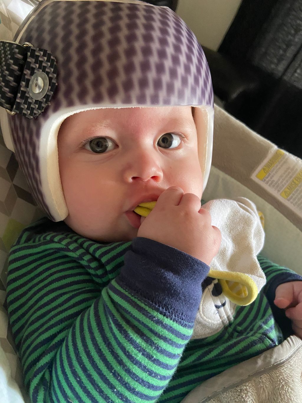 مخاوف الأم عند استخدام خوذة علاج الرأس المسطح للطفل وكيفية التعامل معها بذكاء