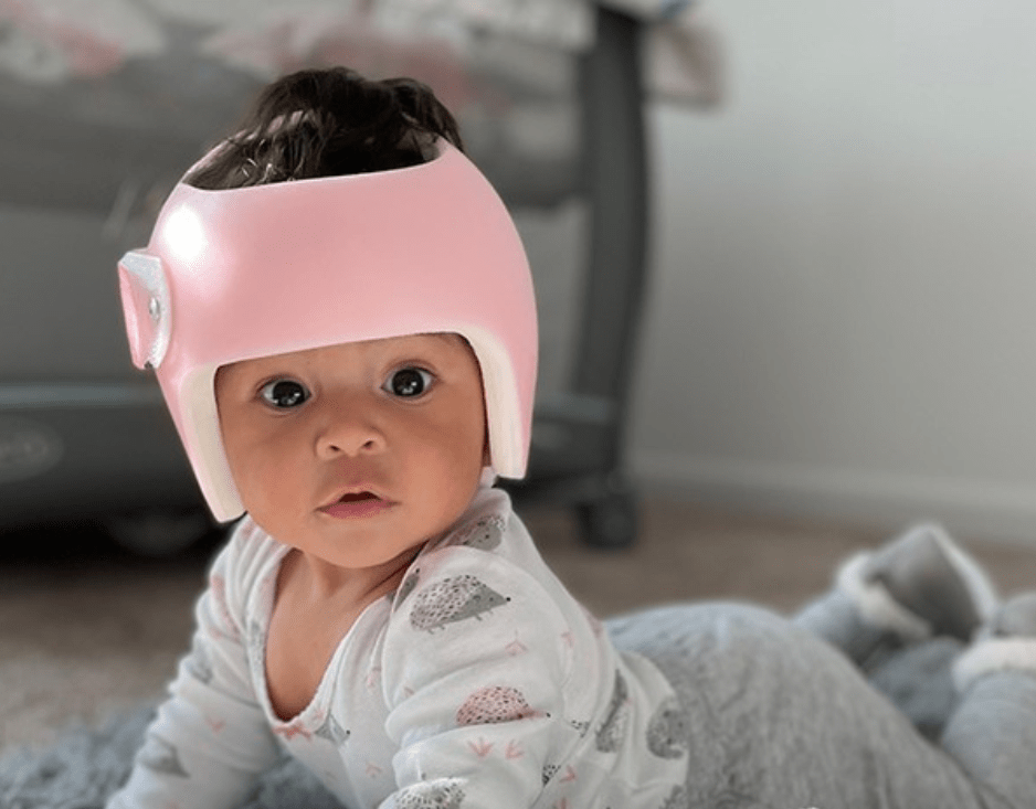 خوذة الرأس المسطح للأطفال ونمو الشعر: الحقيقة وما يجب أن تعرفه كل أم