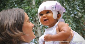 شعور الأم بعد نتائج خوذة علاج الرأس المسطح: الفرح والاطمئنان برؤية تحسن طفلك للأفضل