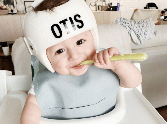 ما هي عيوب خوذة علاج الرأس المسطّح؟ حقائق يجب أن يعرفها الأهل