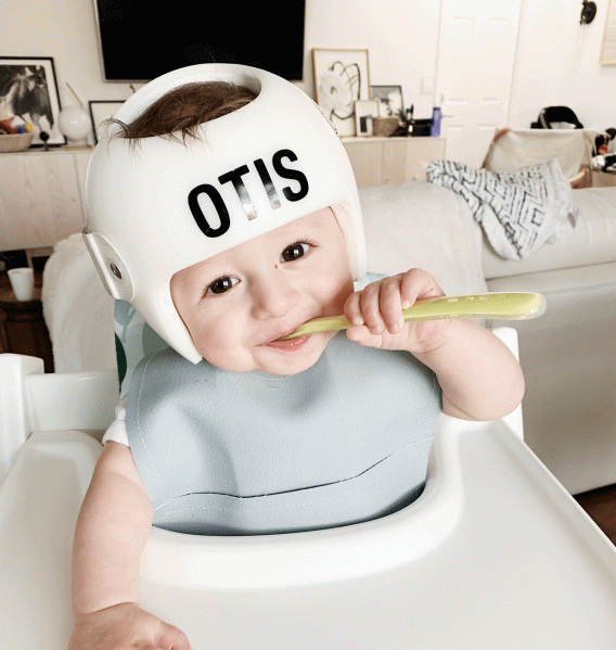 ما هي عيوب خوذة علاج الرأس المسطّح؟ حقائق يجب أن يعرفها الأهل