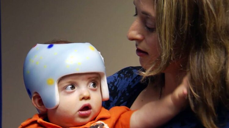 هل تشعر الأم بالندم عند عدم علاج الرأس المسطح بالخوذة؟ وكيف تتصرفين مع طفلك